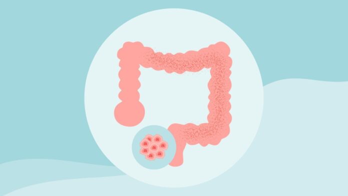 1f00c04e-7402-4a45-b9b4-60a952a85962