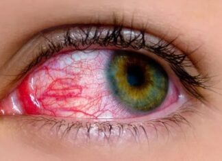 PinkEye: відокремлення правди від вигадки