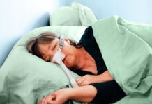 Искусство терапии CPAP: Полное руководство по лечению апноэ сна