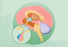 Розуміння акромегалії: причини, симптоми та методи лікування