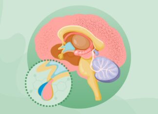 Comprendere l’acromegalia: cause, sintomi e gestione